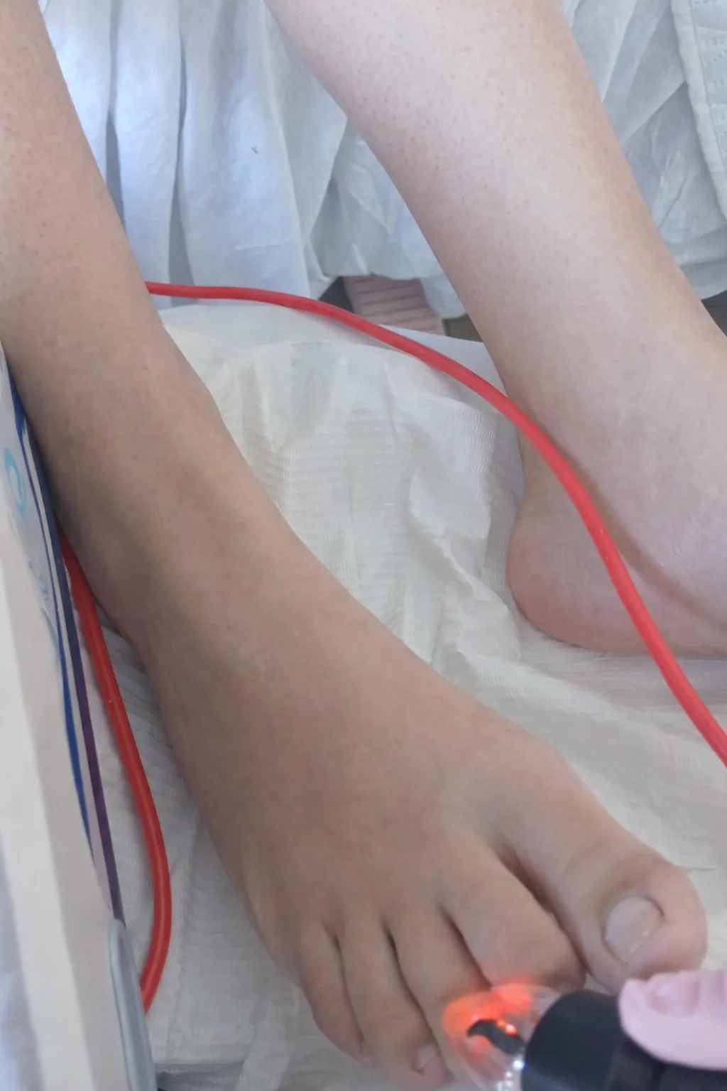 Tratamiento de ozono aplicado en pie